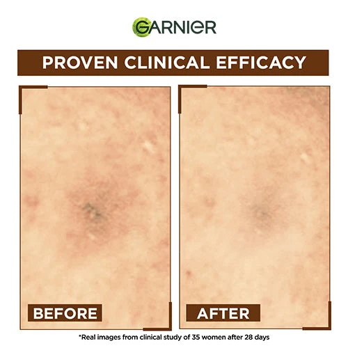 GARNIER BRIGHT COMPLETE OVERNIGHT BOOSTER SERUM 15ML - Image 3