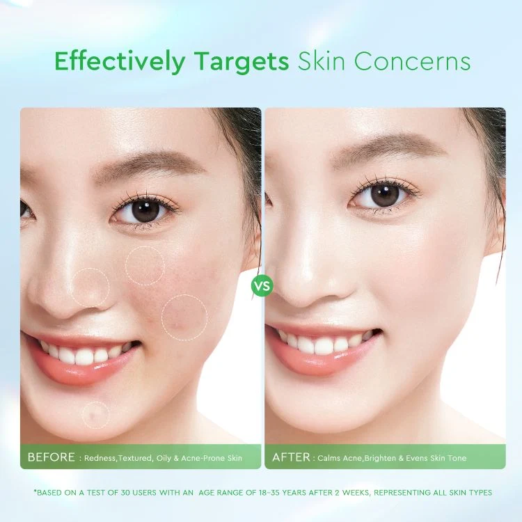 GLAD2GLOW CENTELLA SALICYLIC ACID EXFOLIATING ACNE PADS 30 PCS - Image 5