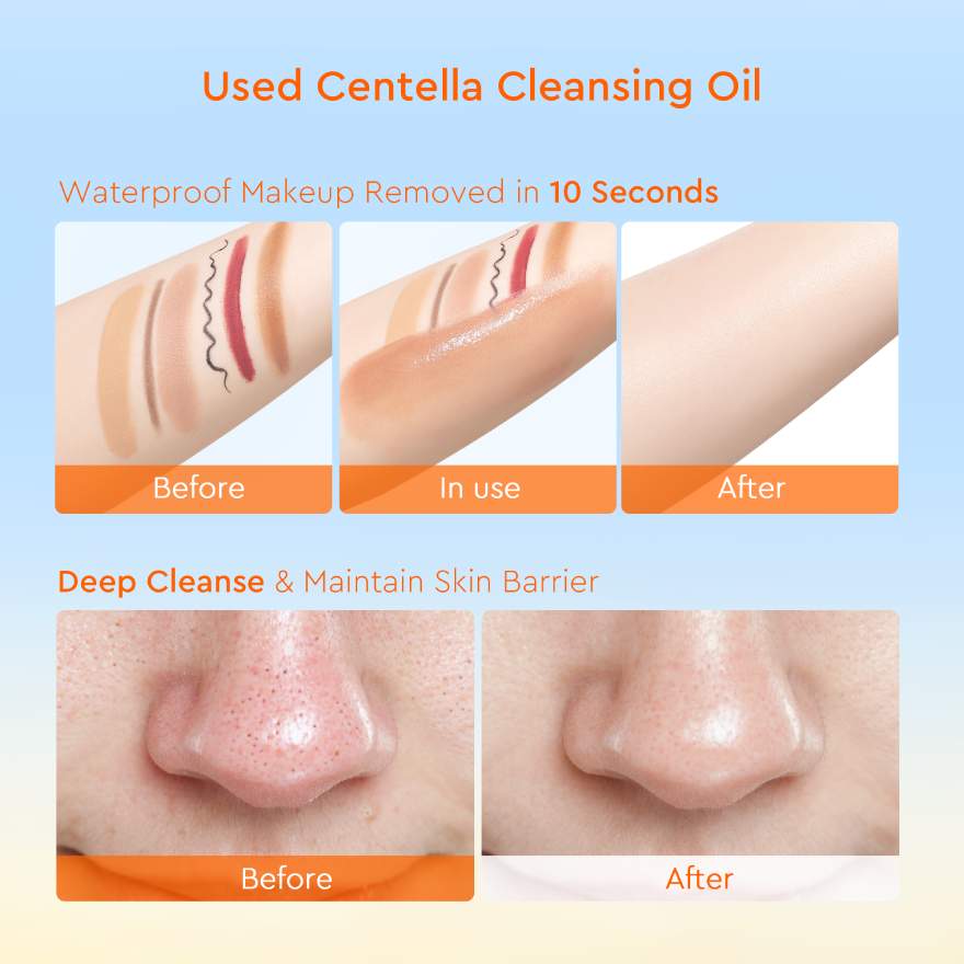 GLAD2GLOW MADAGASCAR CENTELLA LIGHT CLEANSING OIL 100ML - Image 6