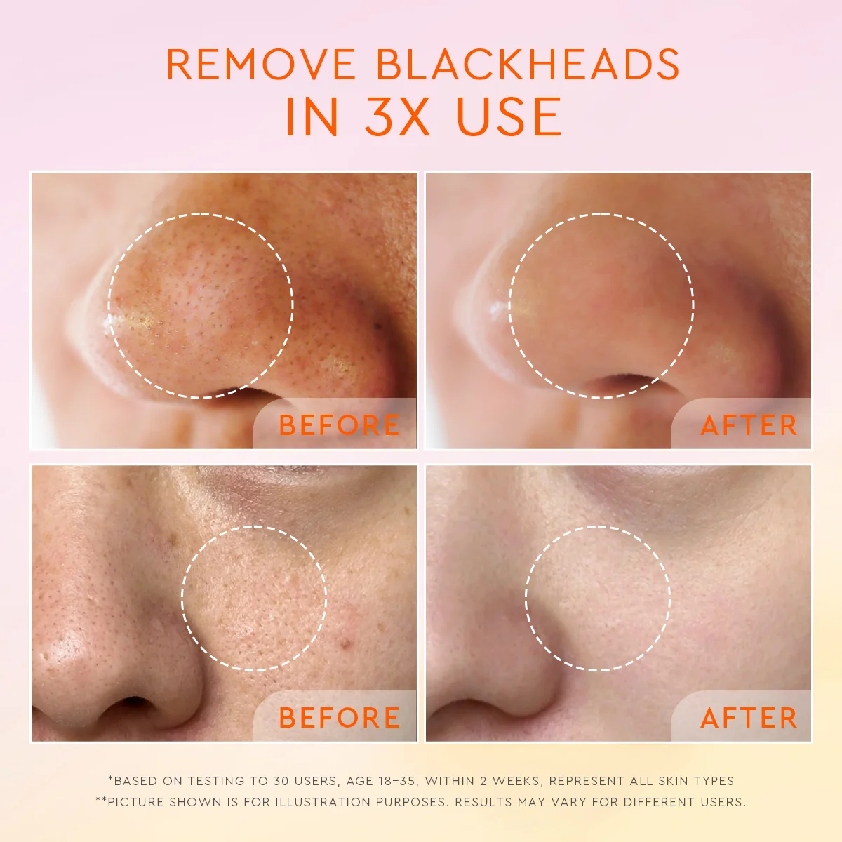 GLAD2GLOW YUZU AHA BLACKHEAD EXFOLIATING CLEANSER 70G - Image 6