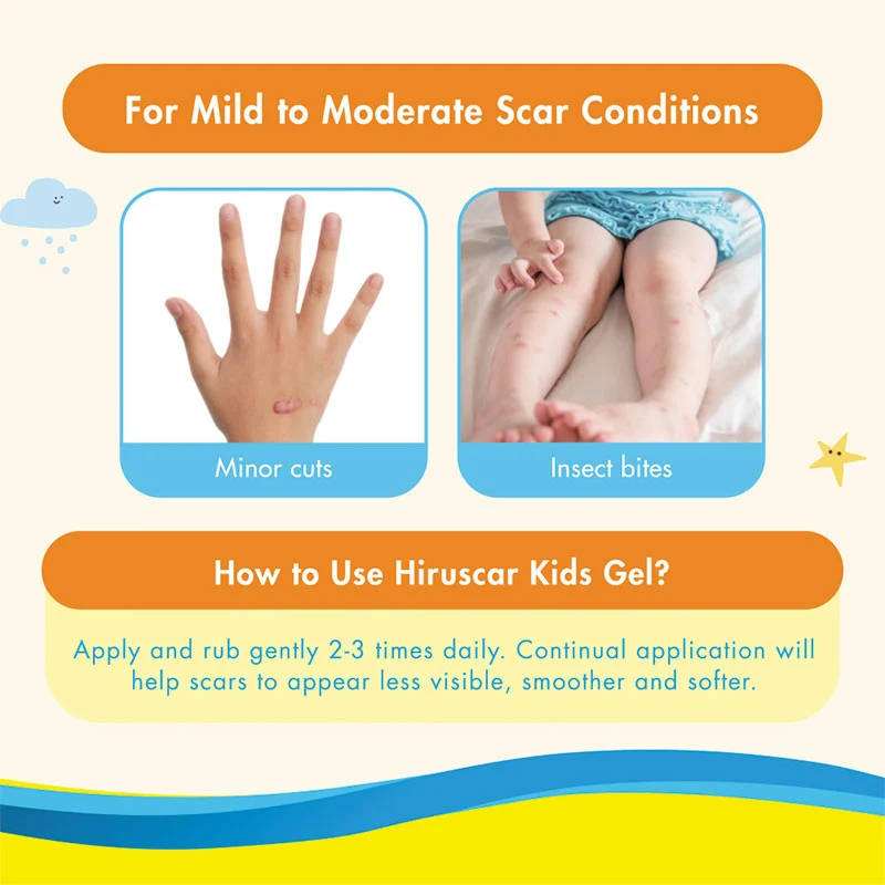 HIRUSCAR KIDS 10G - Image 5