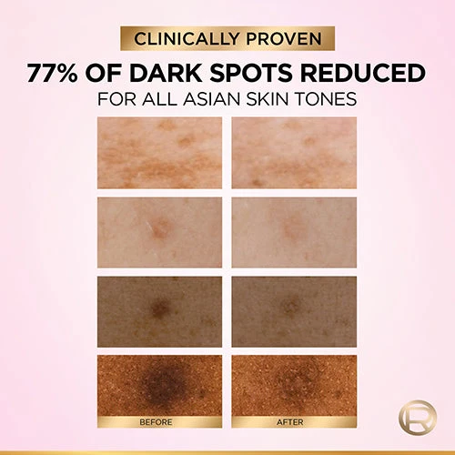 LOREAL GLYCOLIC-BRIGHT STARTER KIT - Image 3